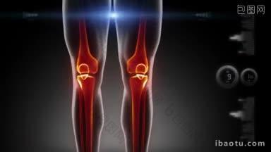 人体膝盖医学扫描